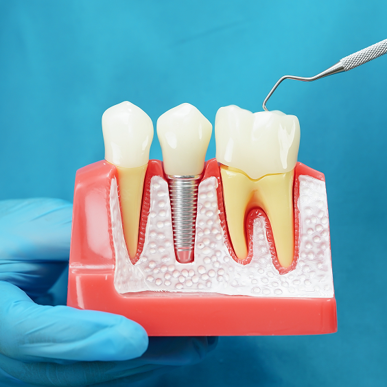 Dental Treatments Overview