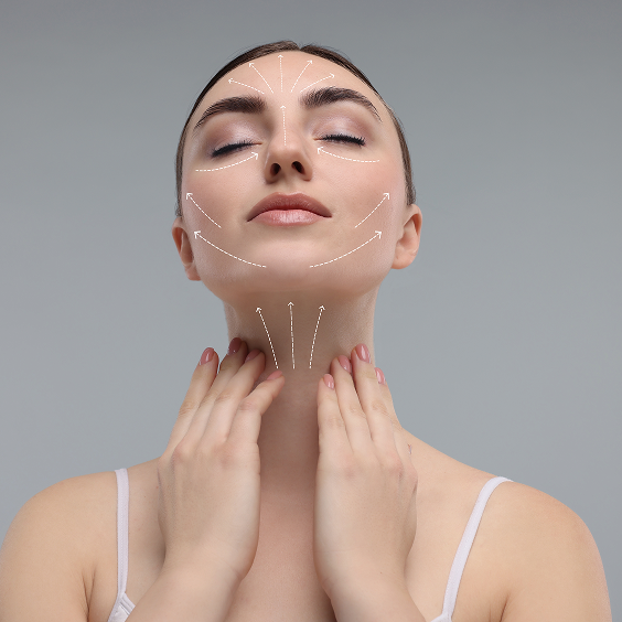 Face and Neck Lift