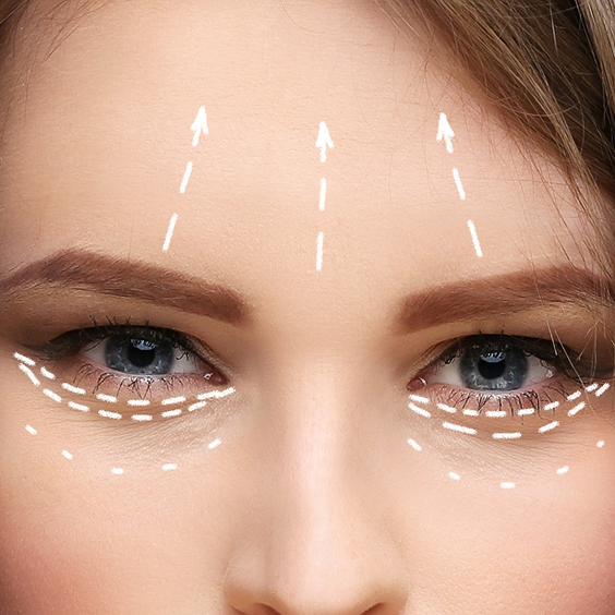 Forehead and Brow Lift