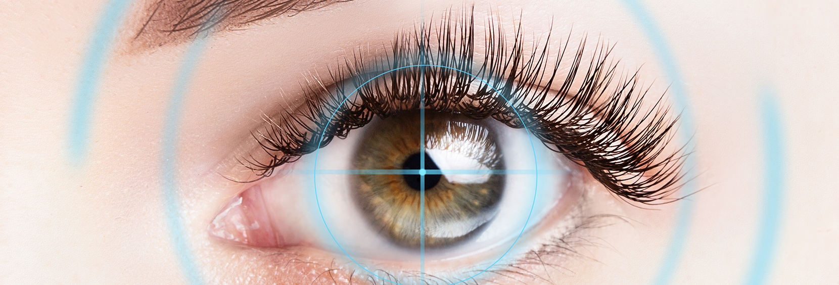 LASIK Surgery